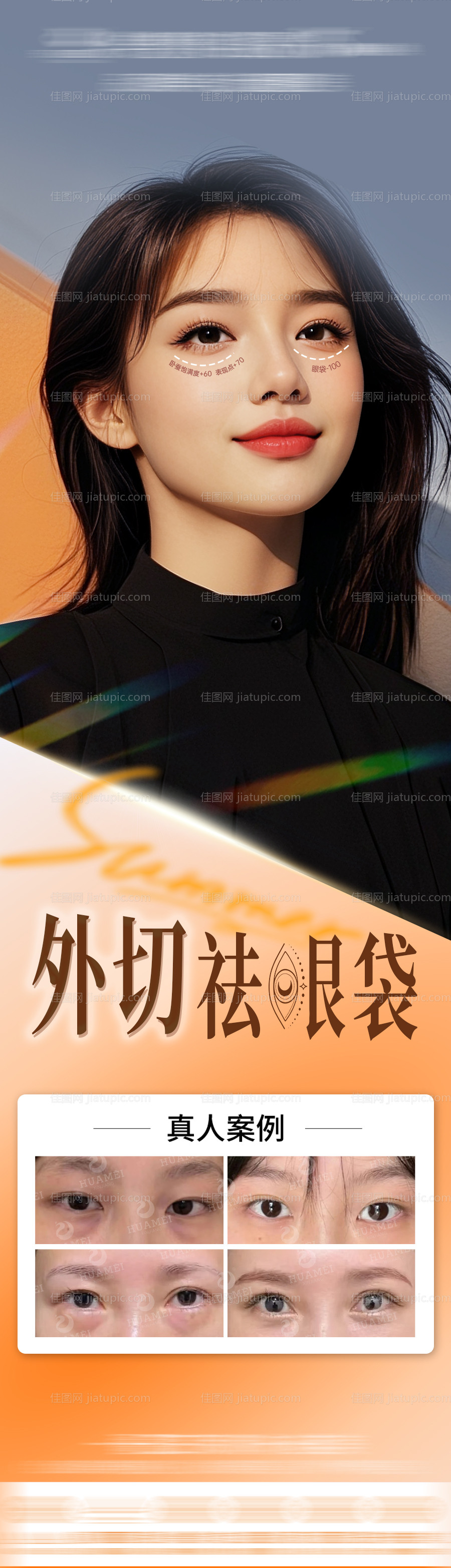 医美外切祛眼袋长图-源文件