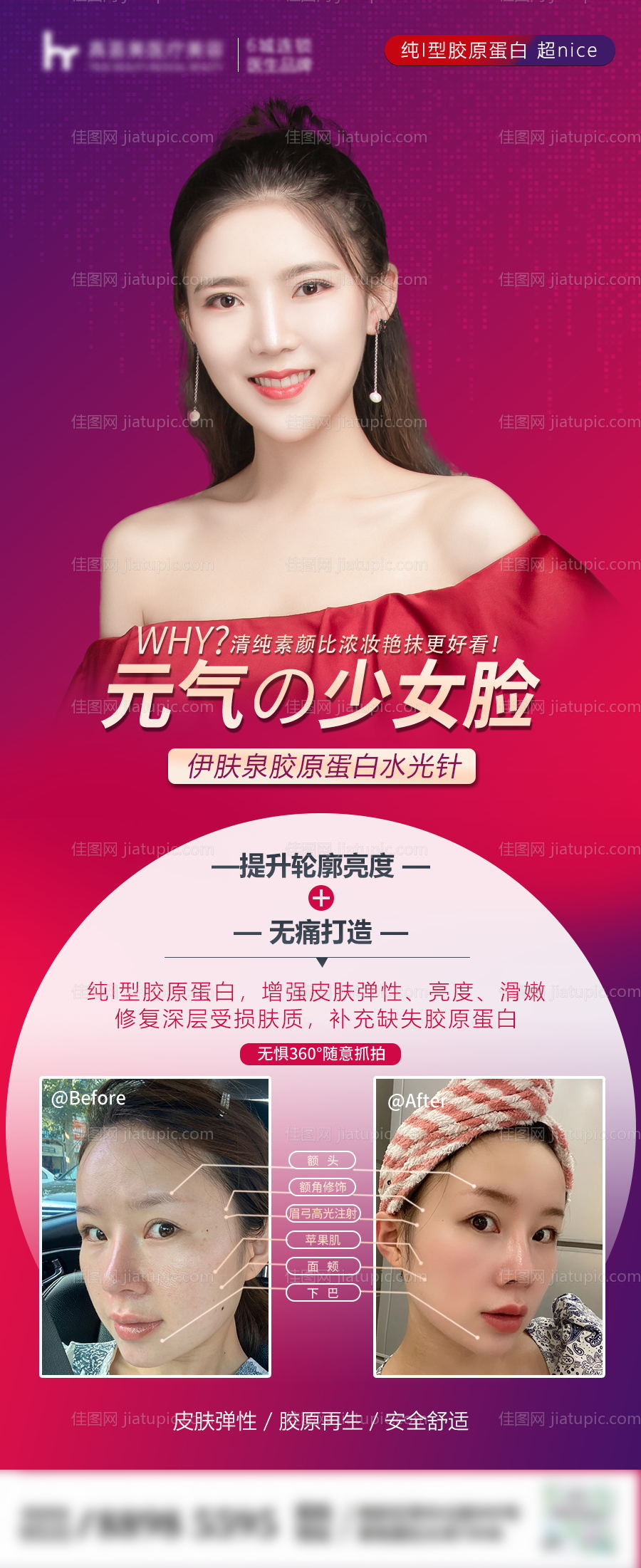 医美整形对比案例海报-源文件