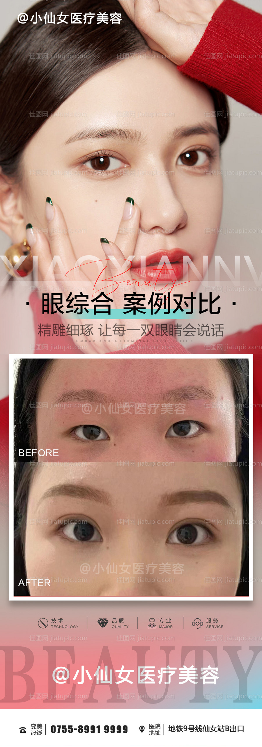 眼综合案例对比海报-源文件