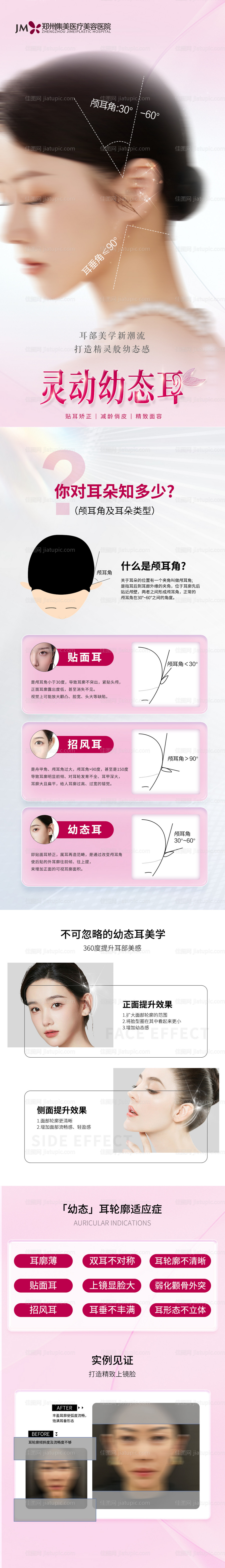 医美精灵耳体验官案例招募-源文件