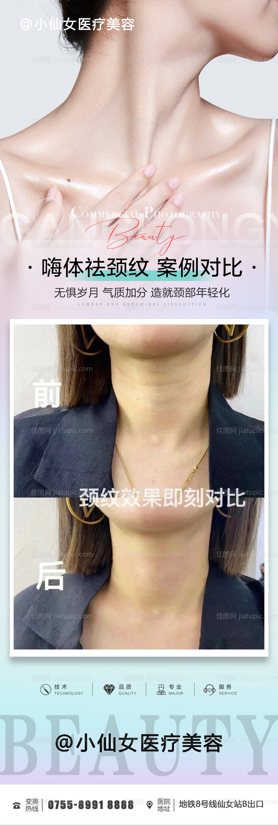 医美微整嗨体祛颈纹案例对比-源文件