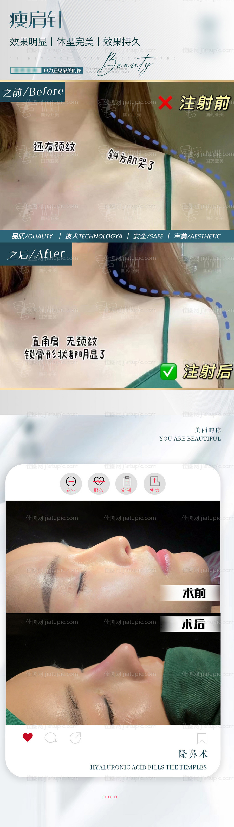 案例对比图-源文件