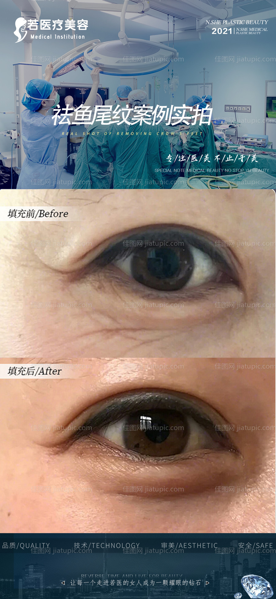 医美眼综合-源文件