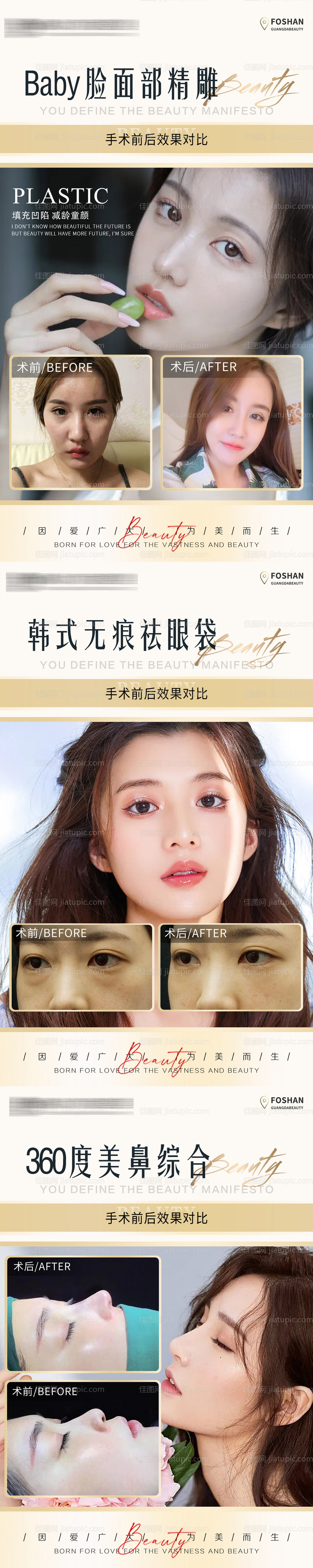 医美真人案例案例对比 真人整形案例集-源文件