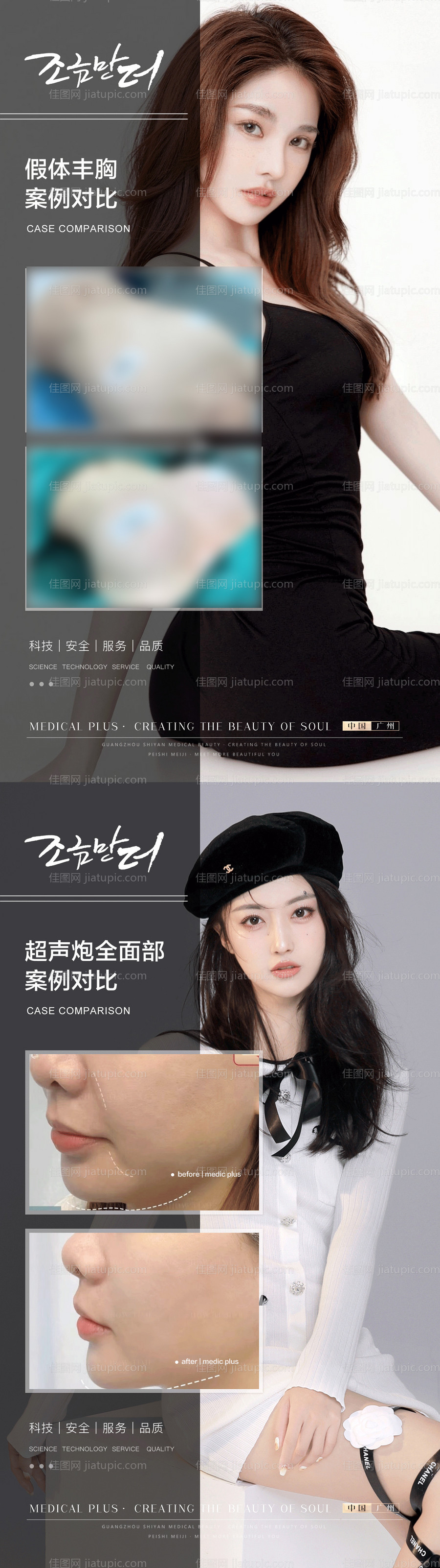 整形真人案例分享集-源文件