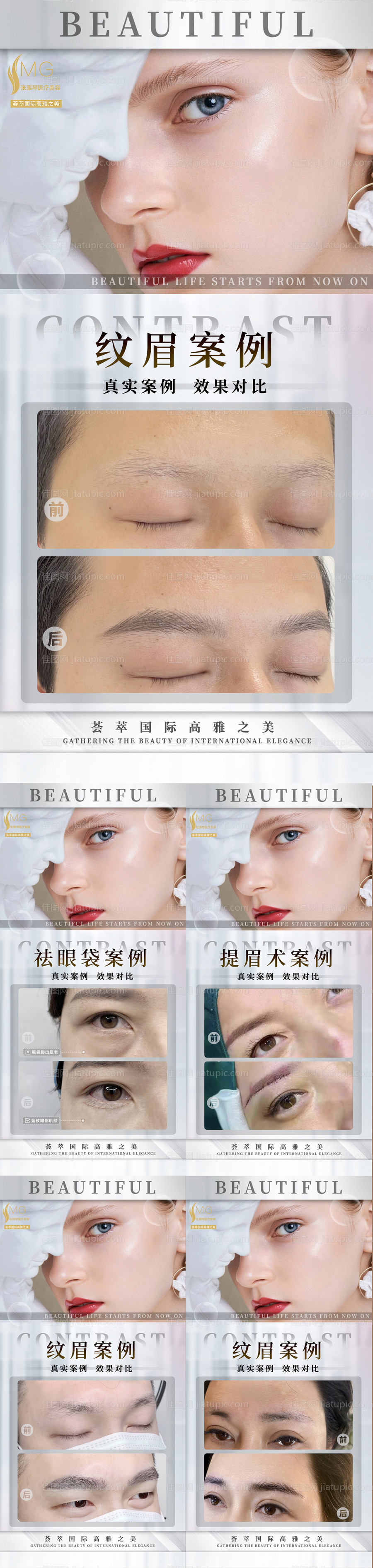 医美纹眉祛眼袋案例-源文件