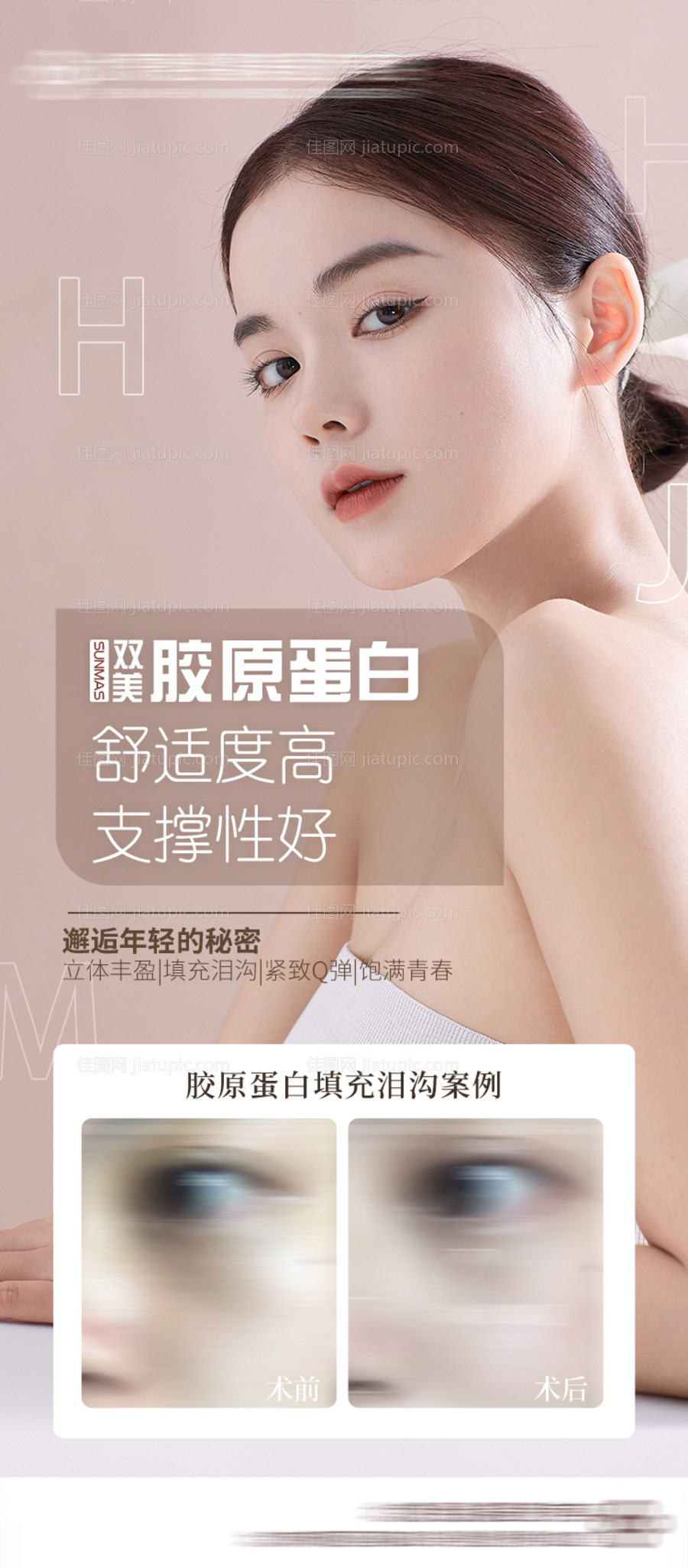 医美胶原蛋白案例对比海报-源文件