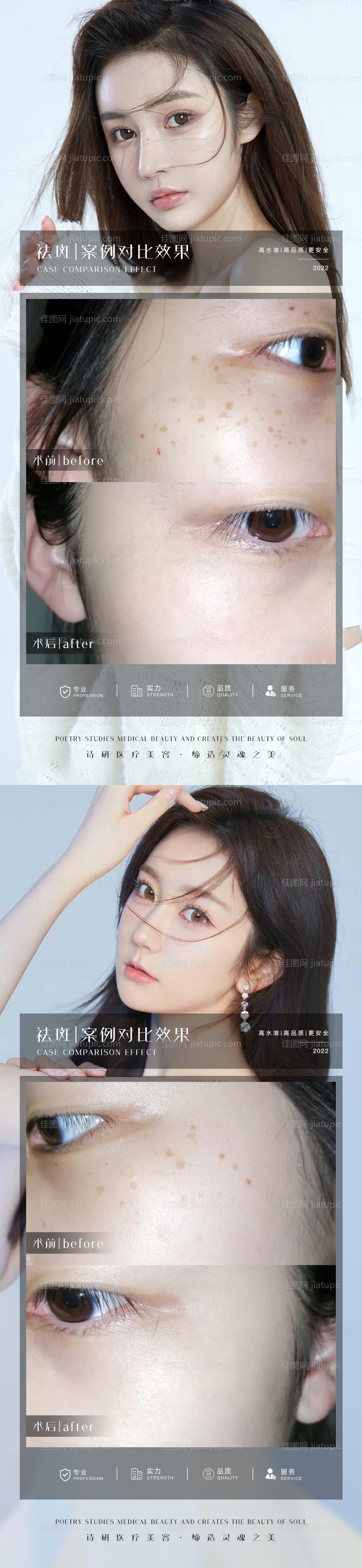 医美祛斑案例海报-源文件