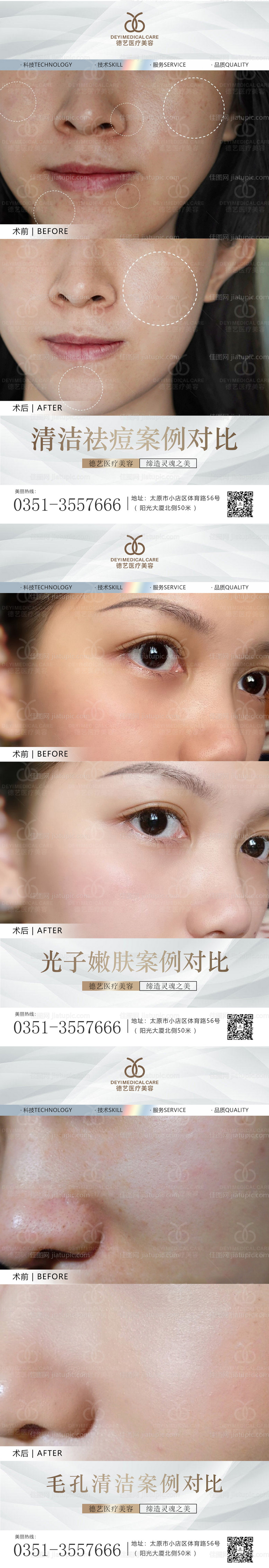 医美案例对比图-源文件