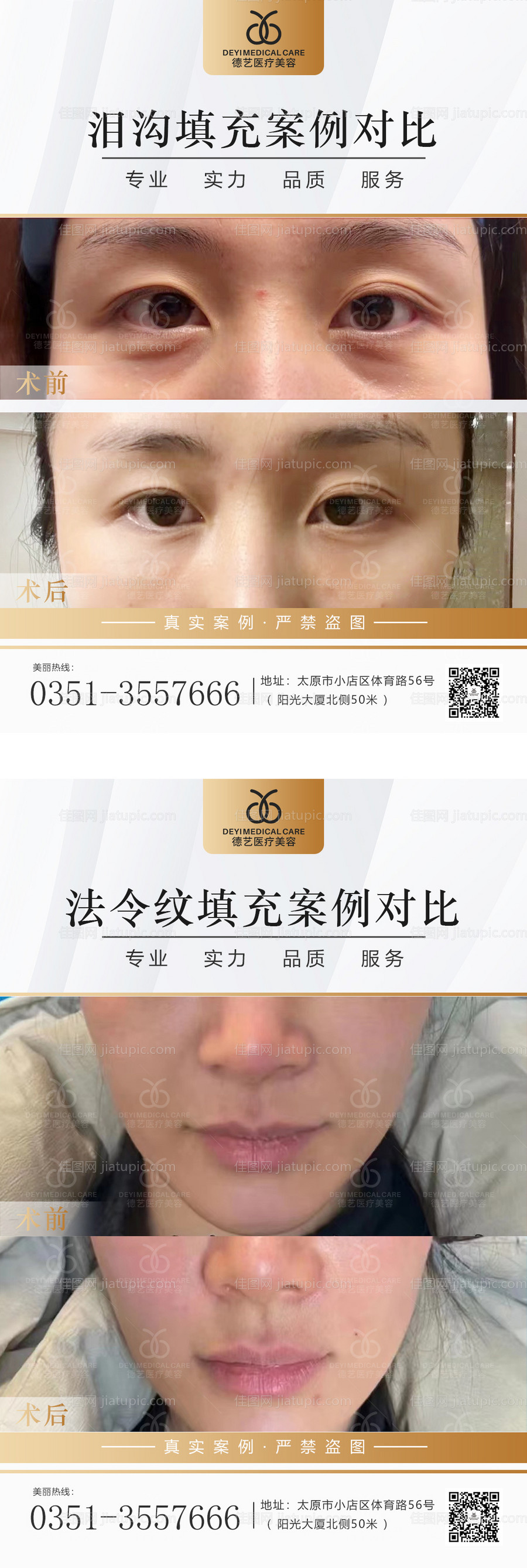 医美案例对比图-源文件