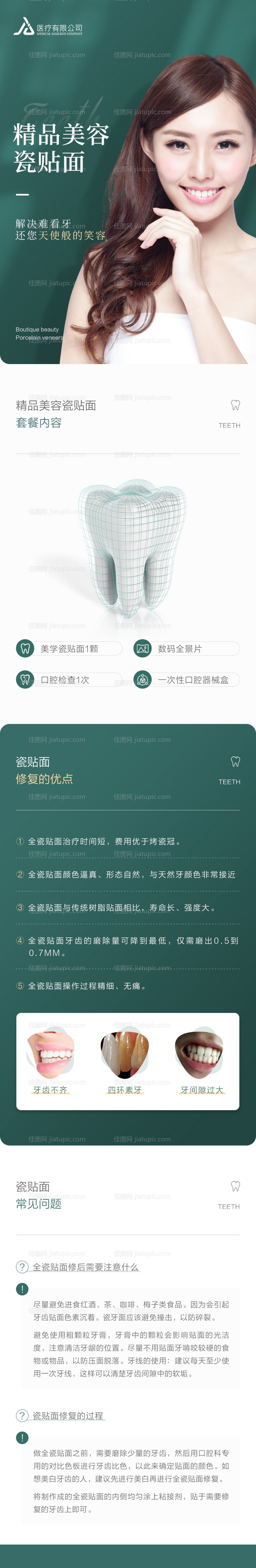 精品美容瓷贴面-源文件