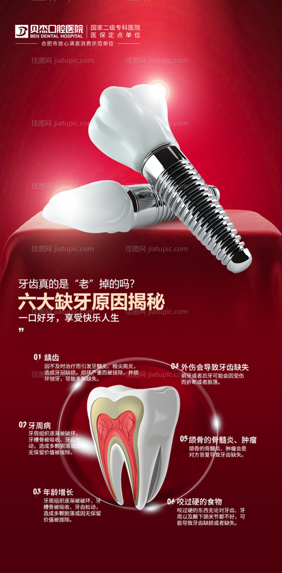 种植牙海报-源文件
