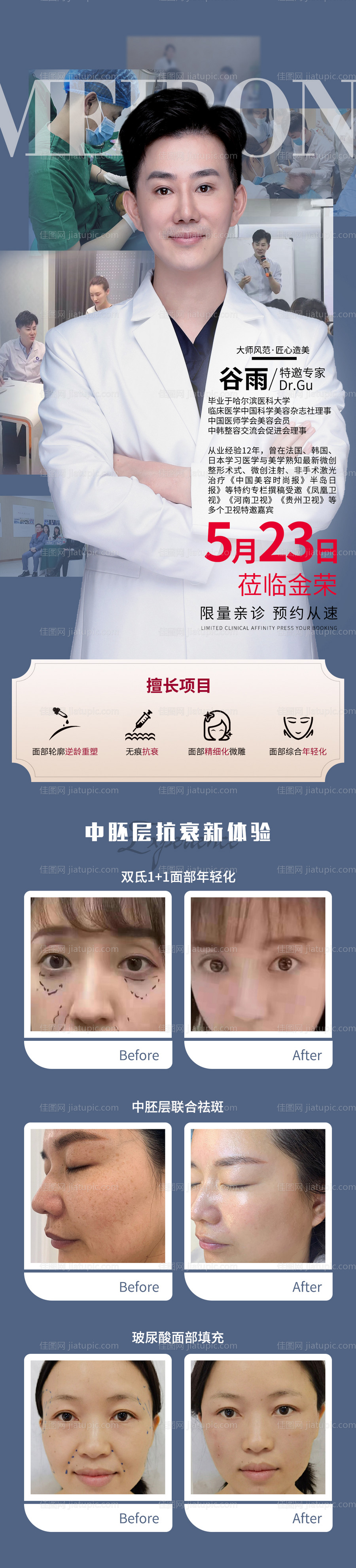 医美专家介绍专题-源文件