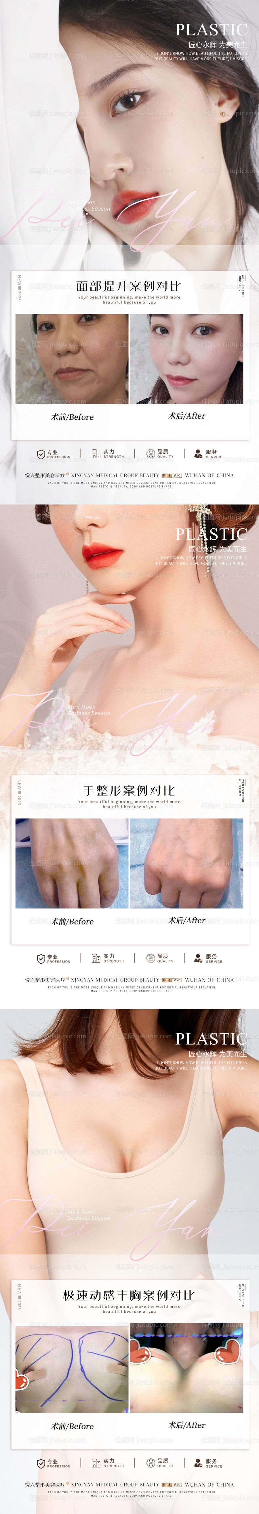 整形真人案例分享集-源文件