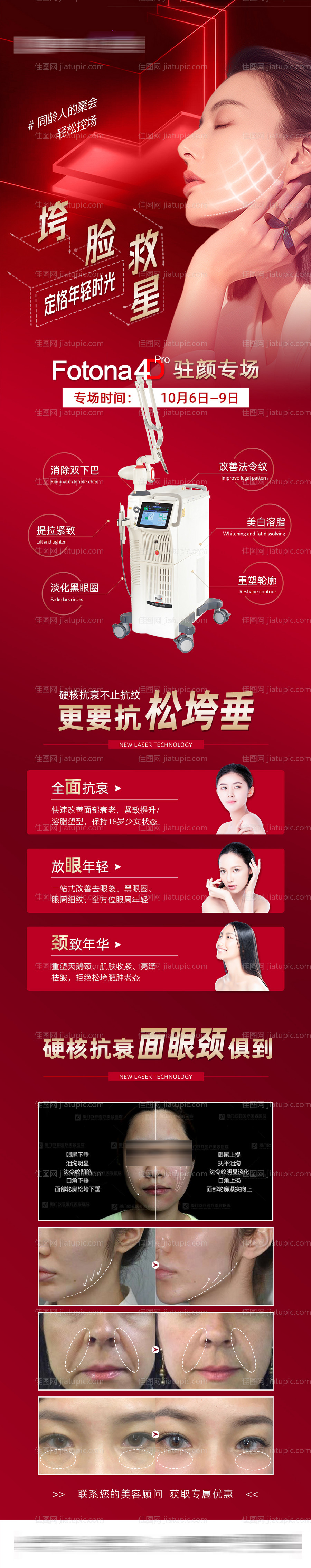 fotona4D长图-源文件