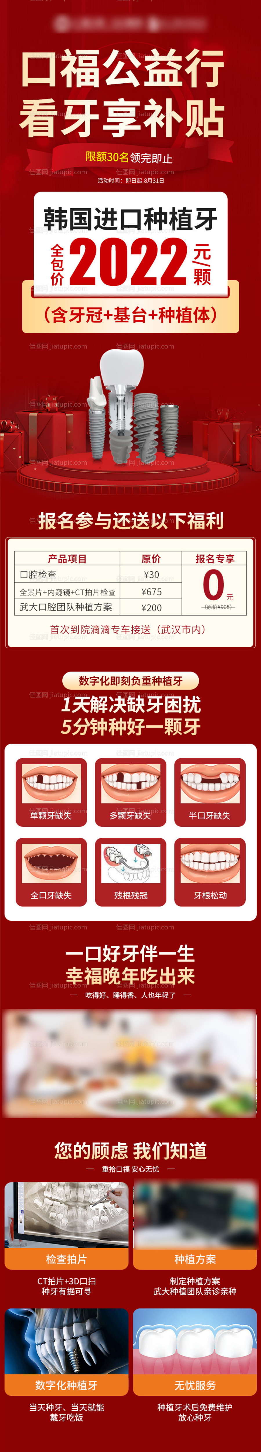 种植牙活动长图海报-源文件