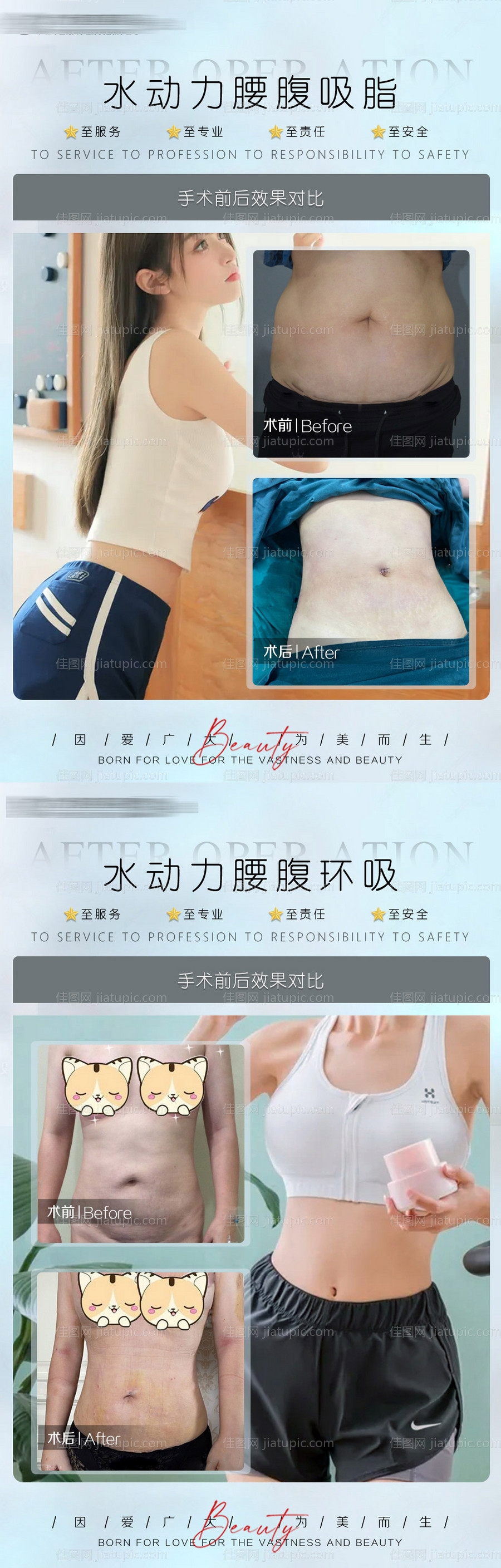 医美真人案例案例对比 -源文件