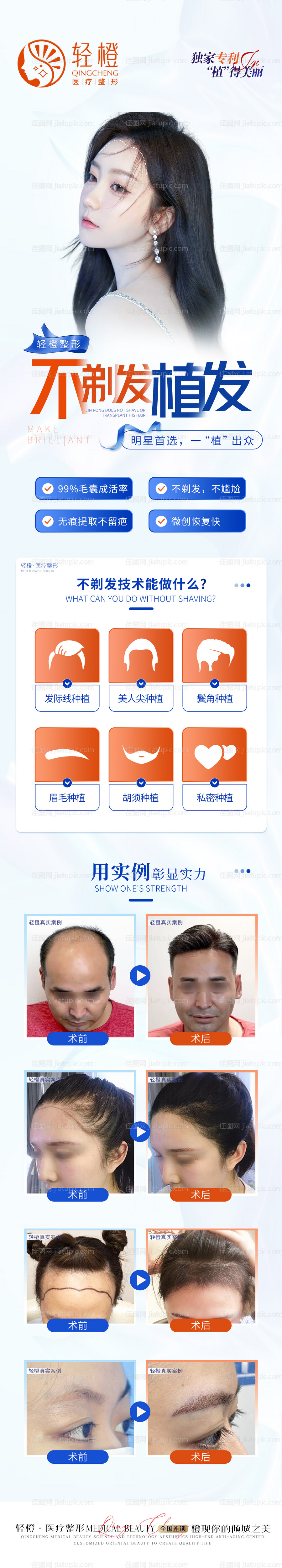 不剃发植发海报-源文件