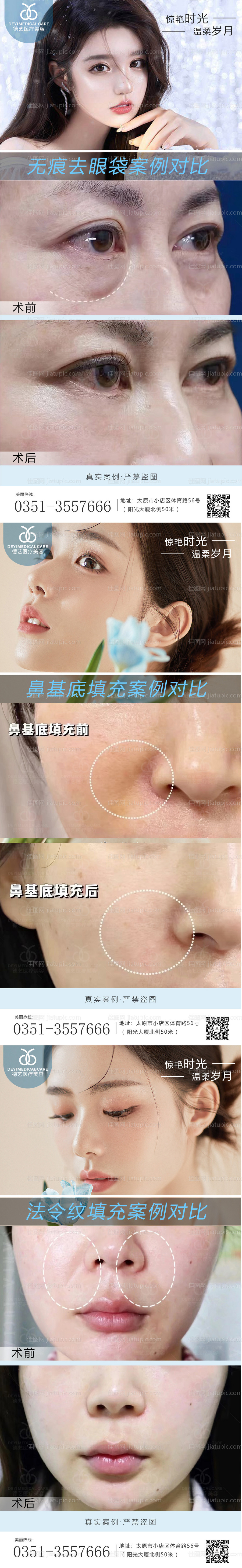 医美案例对比图-源文件