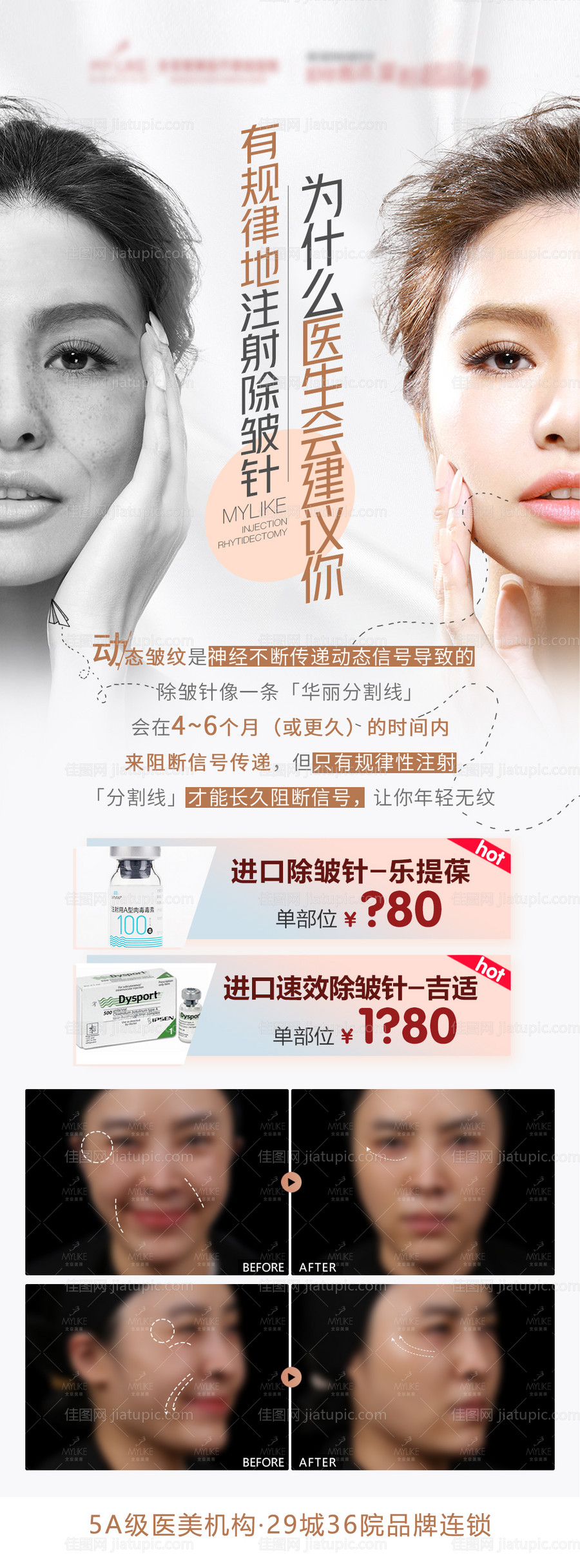 也没肉毒素除皱针朋友圈长图-源文件