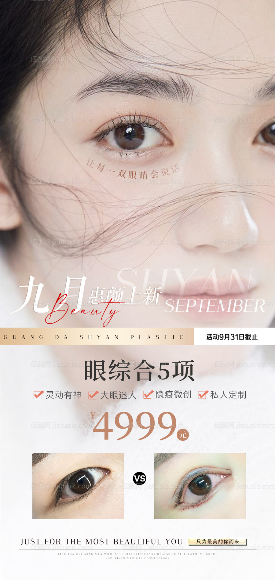 医美双眼皮案例对比海报-源文件