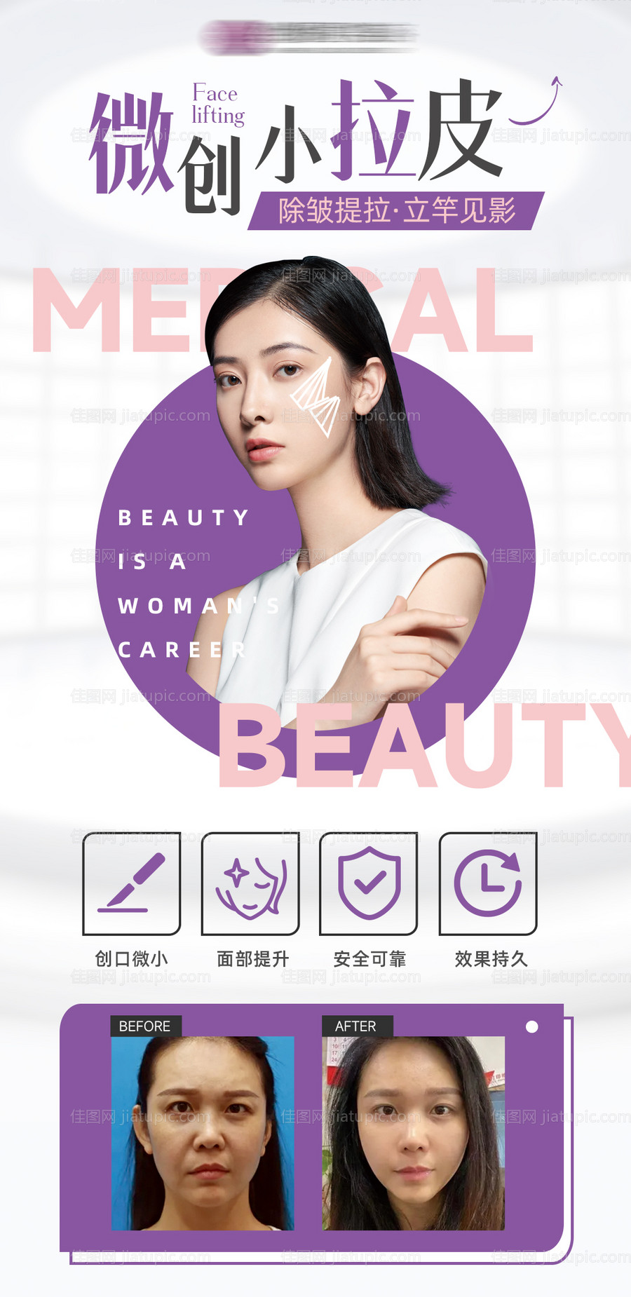医美面部提升线雕海报-源文件