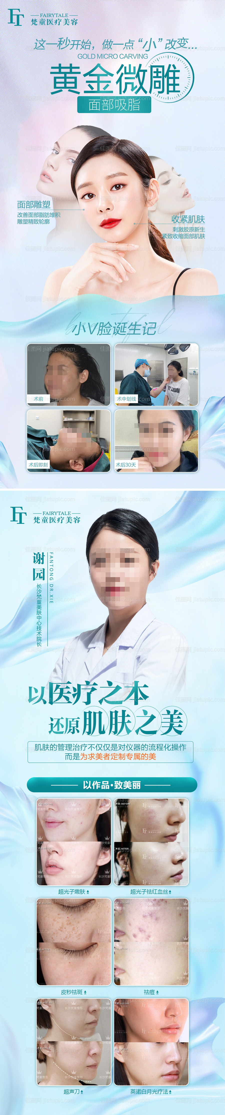 黄金微雕医美案例系列海报-源文件