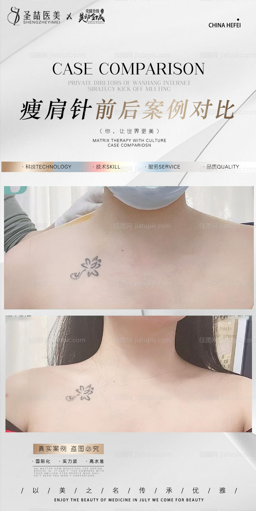 医美案例海报-源文件