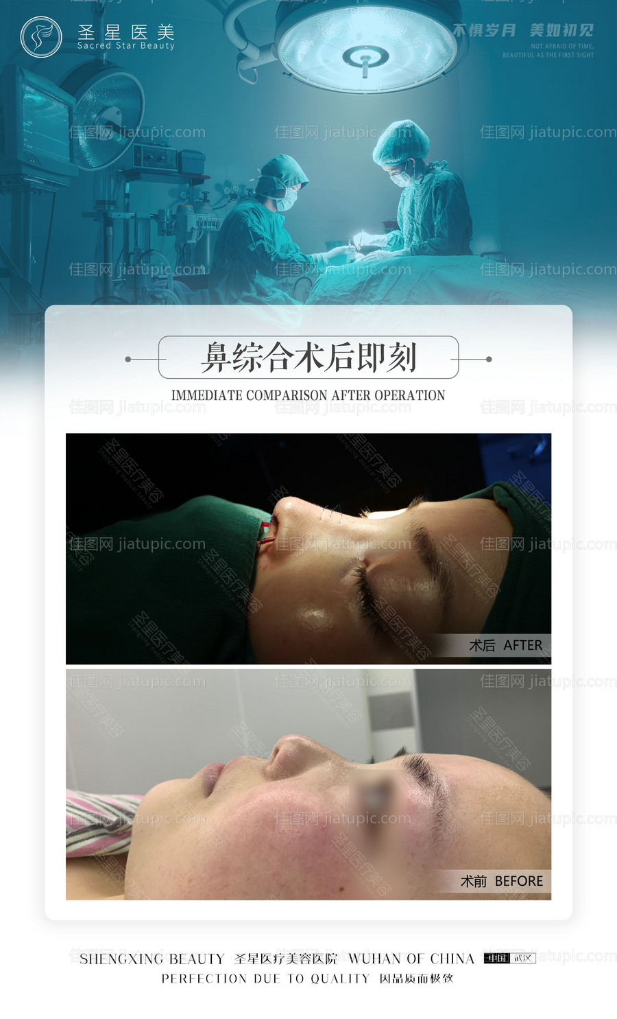 医美整形案例-源文件