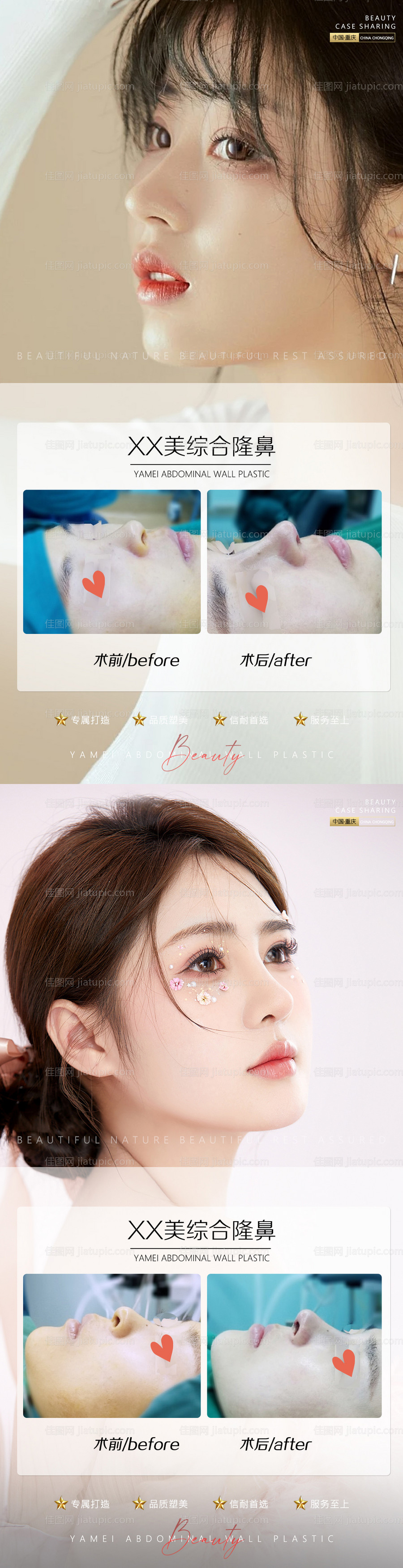 医美案例眼睛海报-源文件