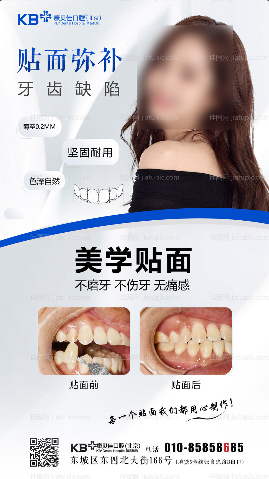 贴面弥补牙齿缺憾-源文件