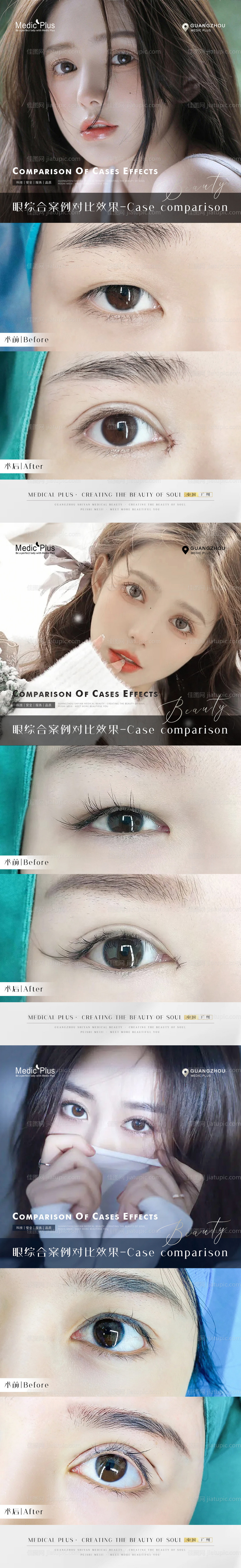 医美案例对比海报-源文件