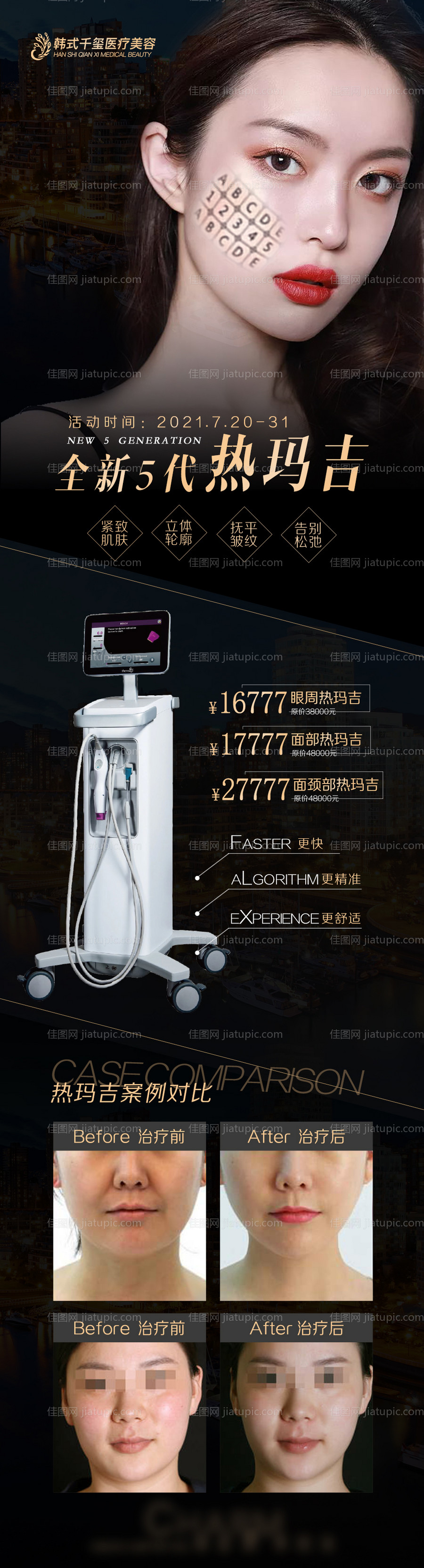 医美仪器热玛吉长图-源文件