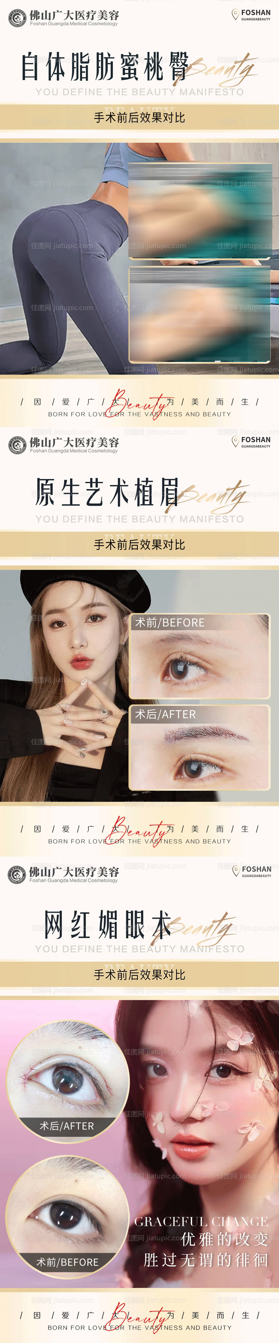 整形真人案例分享集-源文件