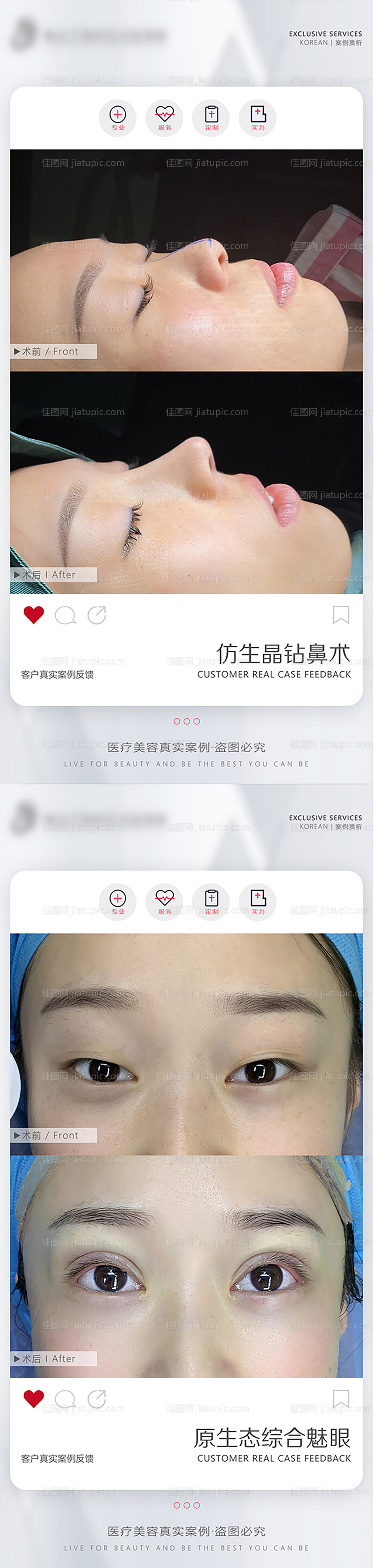 医美案例对比-源文件