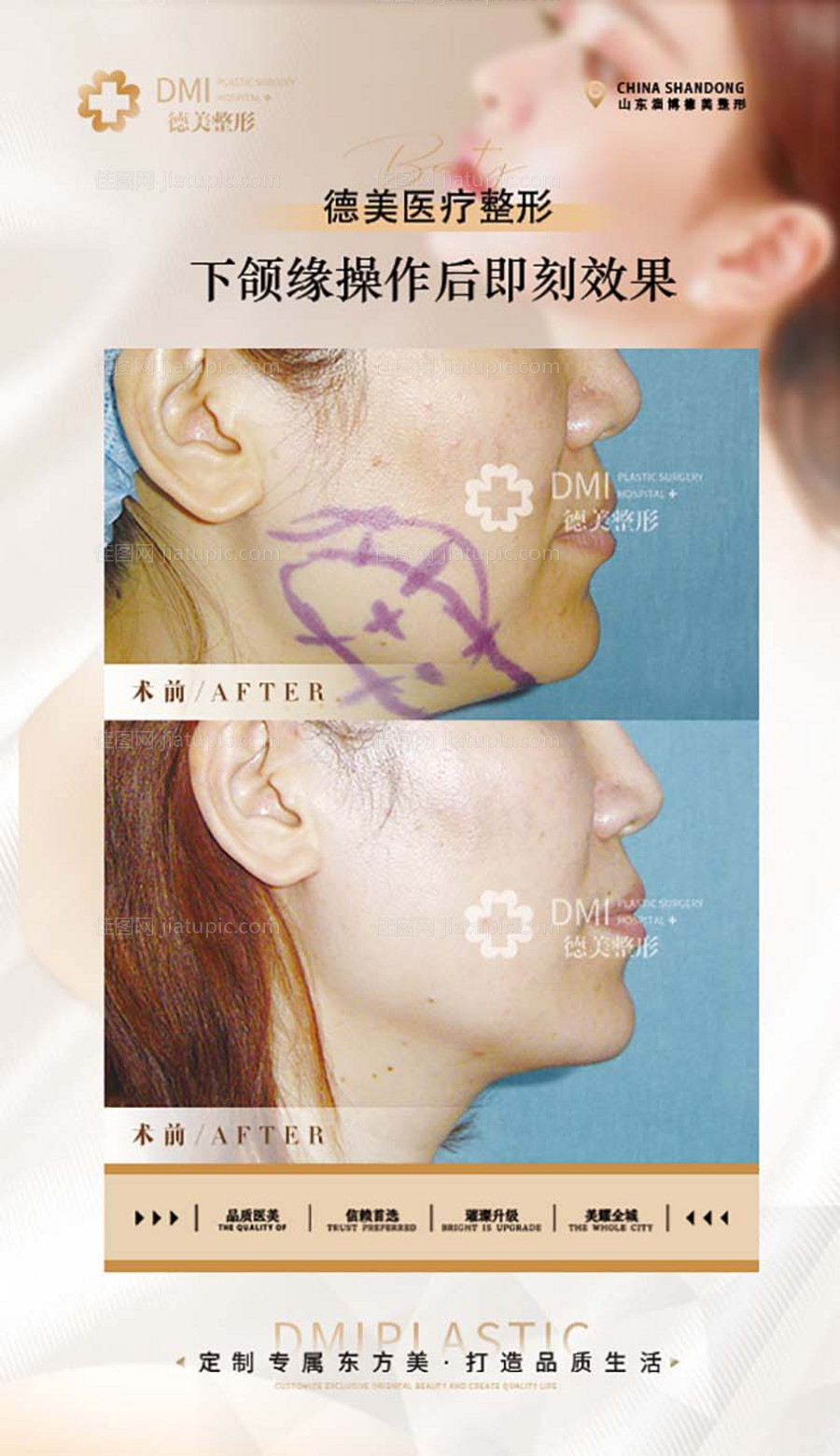 医美对比图-源文件