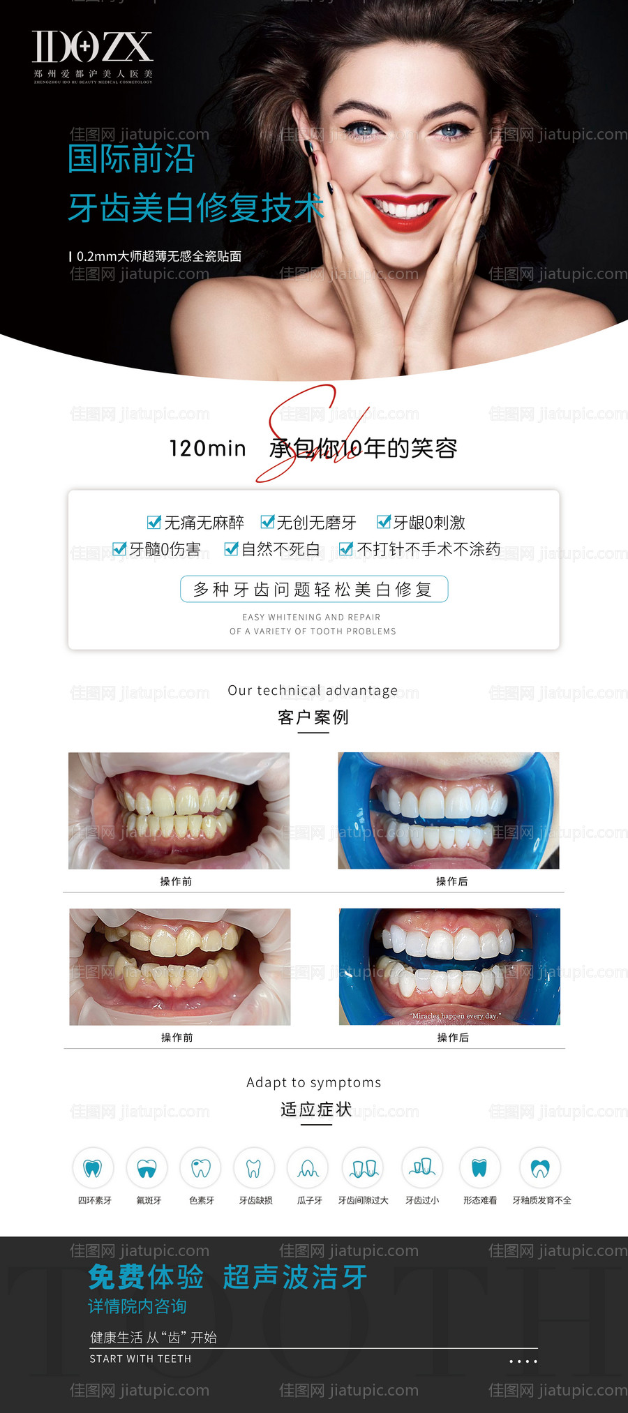 口腔牙贴面美牙展架-源文件