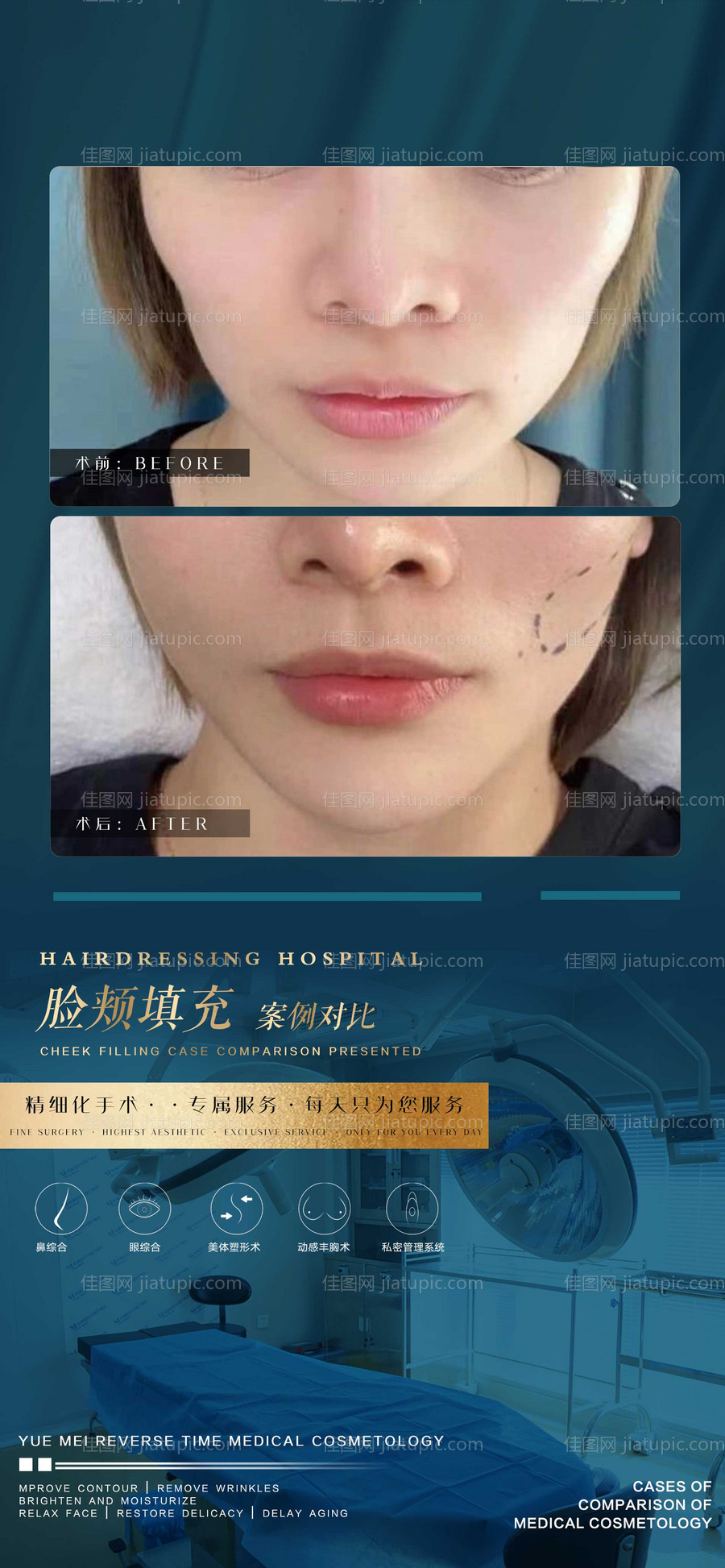 医美案例宣传海报-源文件