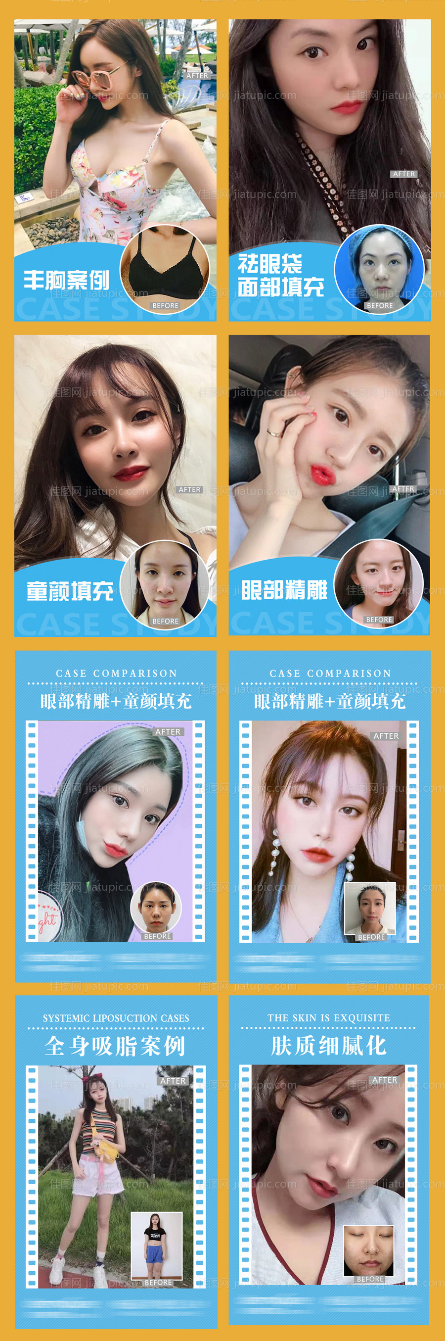 医美整形案例对比系列海报-源文件