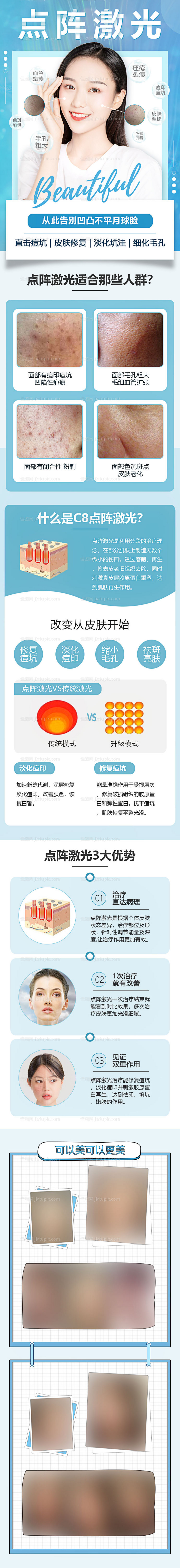 医美整形点阵激光电商详情页-源文件