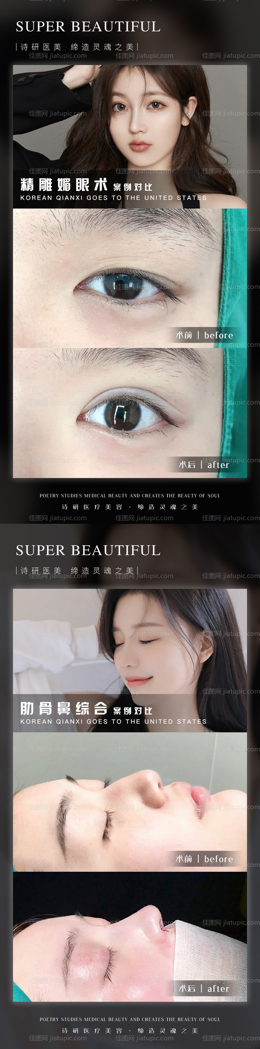 医美案例对比系列海报-源文件