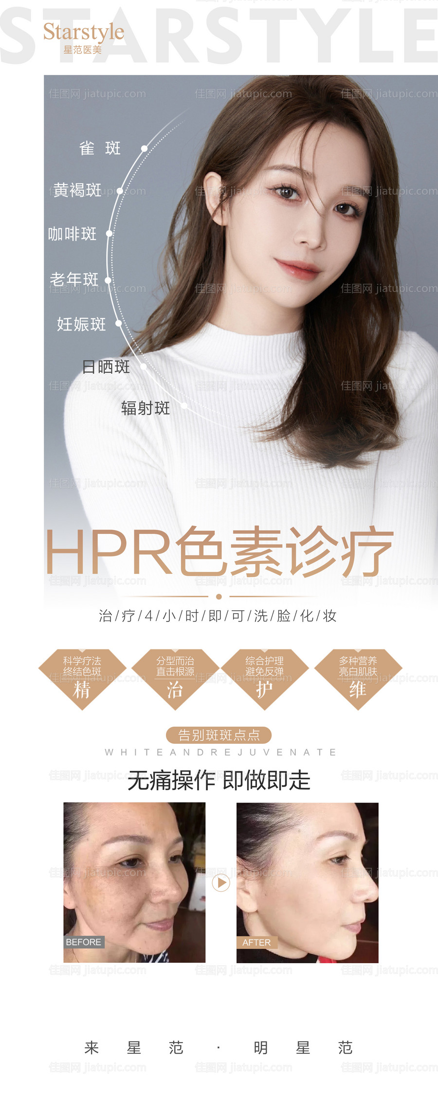 医美整形祛斑人物案例展架-源文件