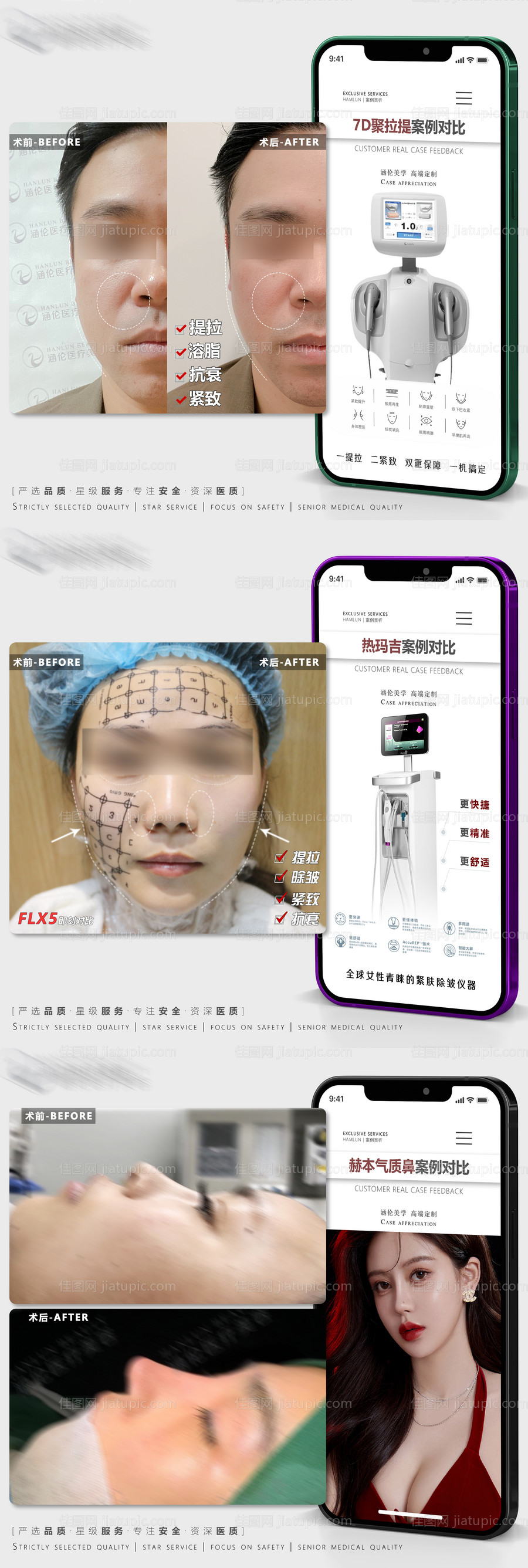 案例模板对比系列海报-源文件