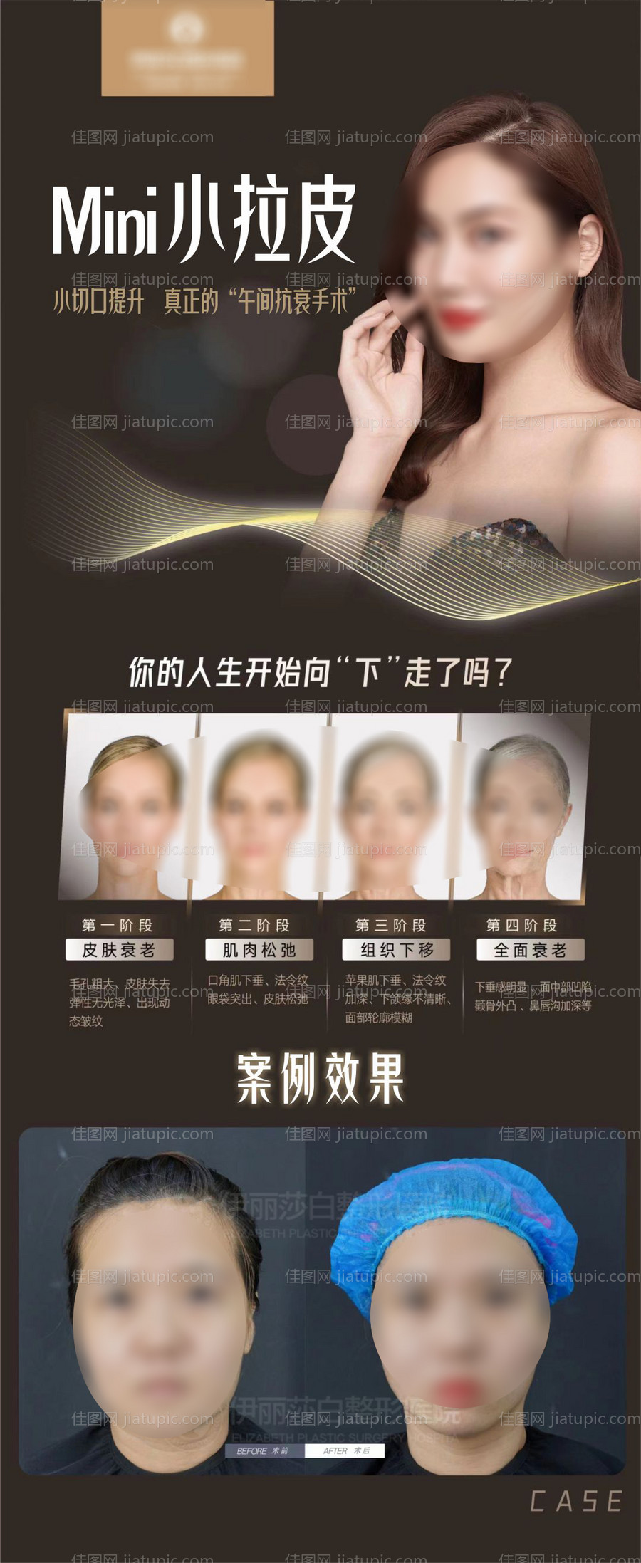 医美小拉皮案例海报-源文件