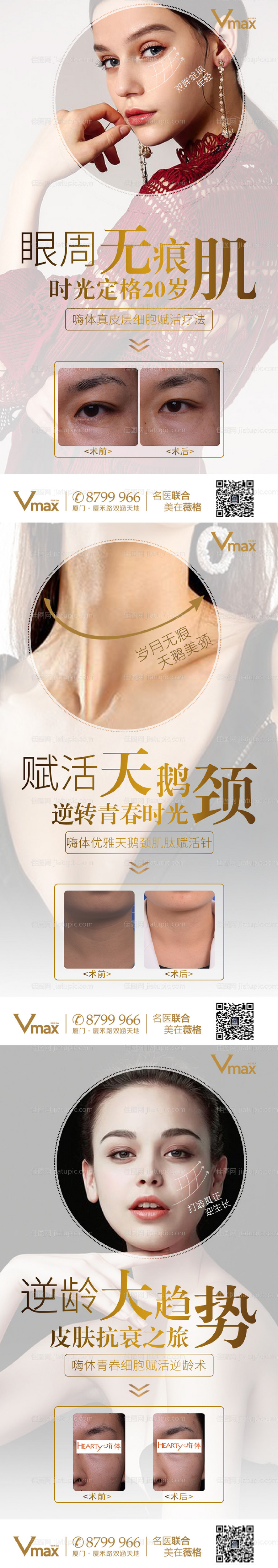 医美嗨体天鹅颈海报-源文件