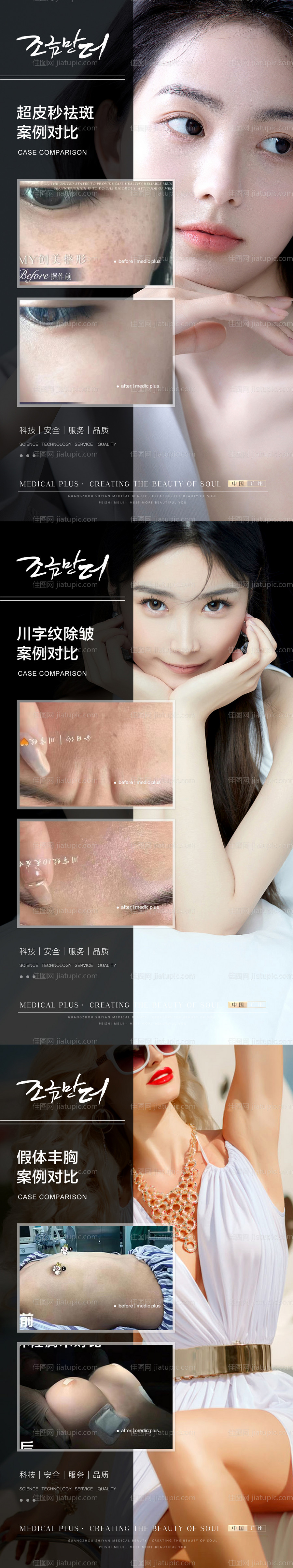 整形真人案例分享集-源文件