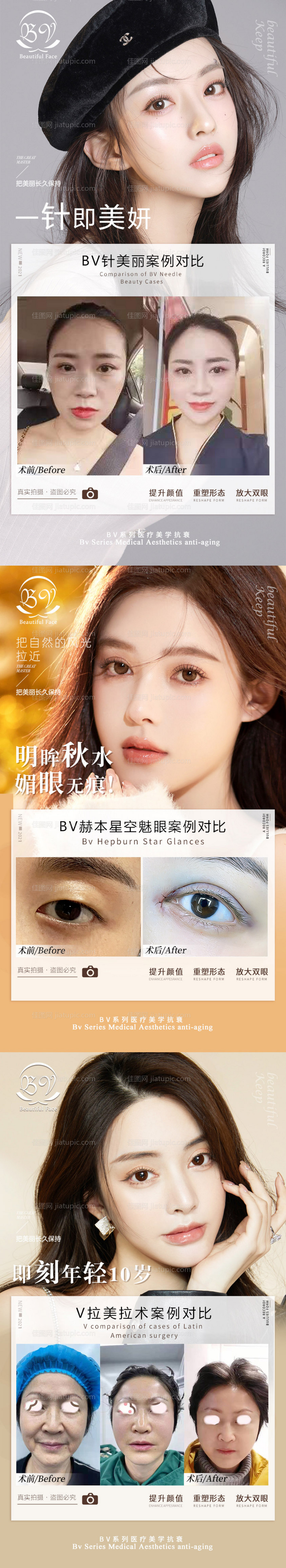 医美案例系列海报-源文件