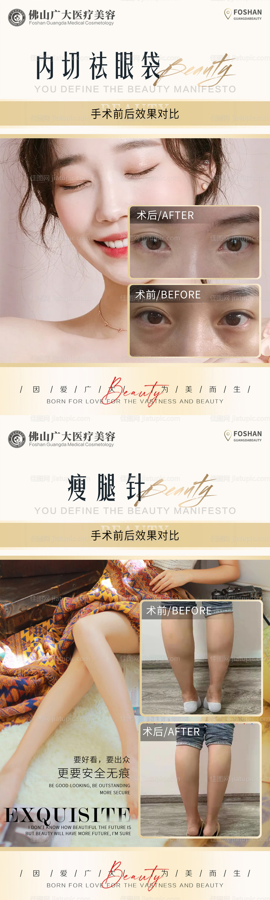 医美双祛眼袋瘦腿案例长图海报-源文件