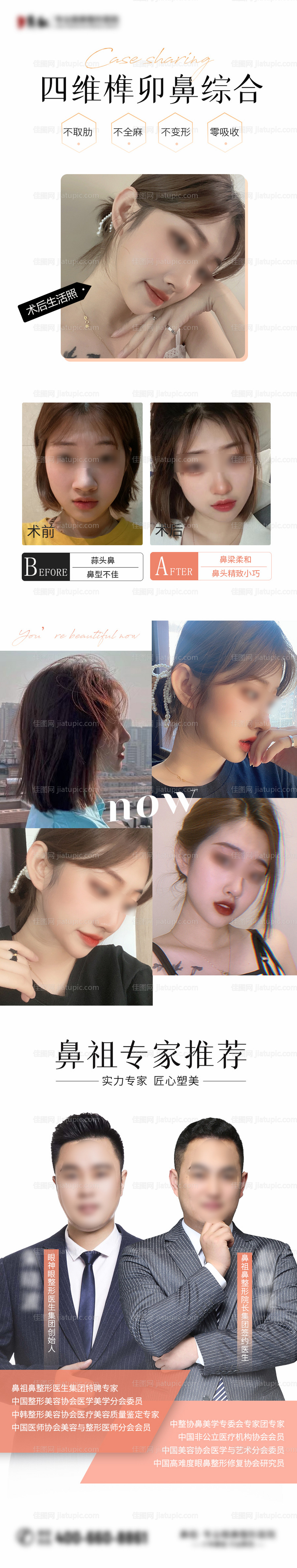 医美隆鼻对比海报-源文件