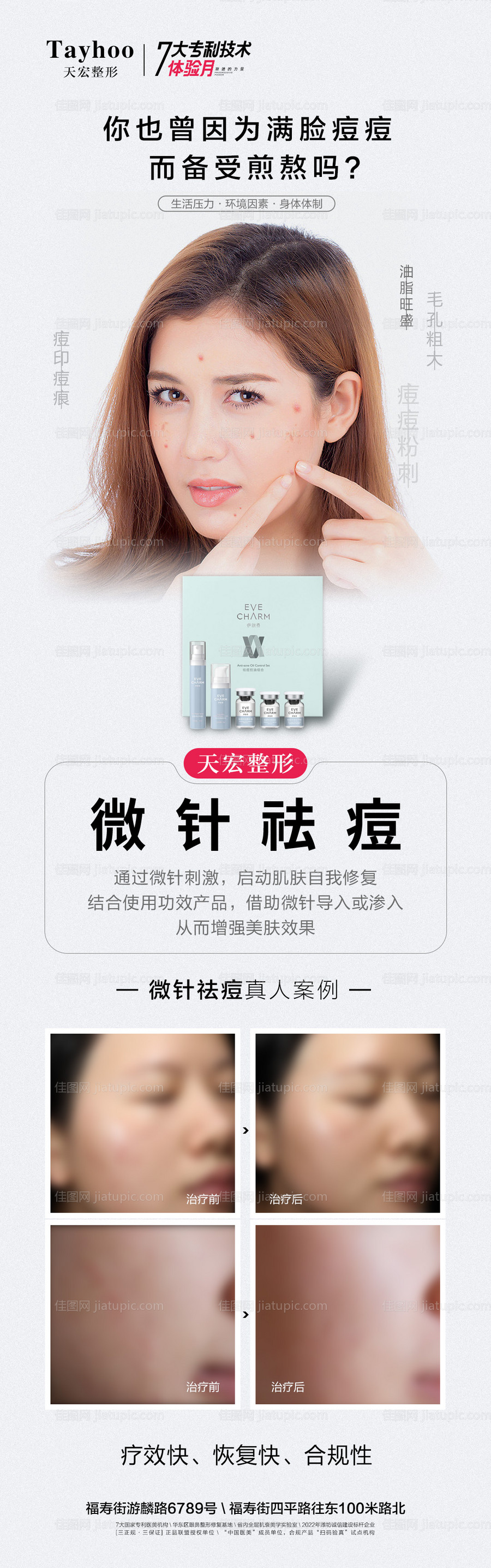 微针祛痘长图-源文件